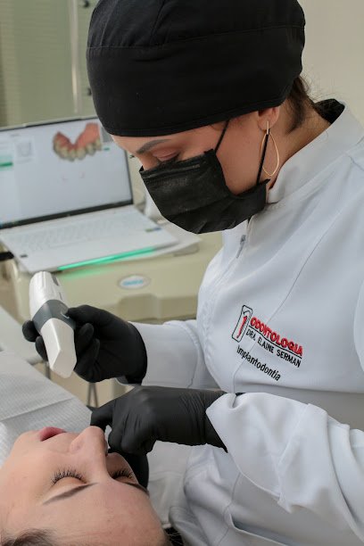 Serman Odontologia | Implante Dentário em Ponta Grossa